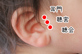子供の難聴治療